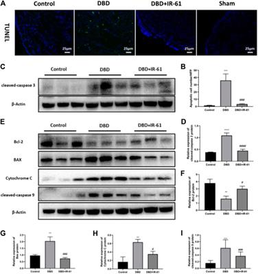 IR-61 Improves Voiding Function via Mitochondrial Protection in Diabetic Rats